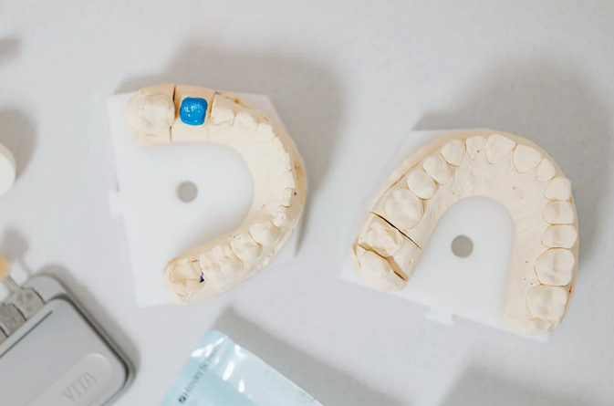 teeth implants